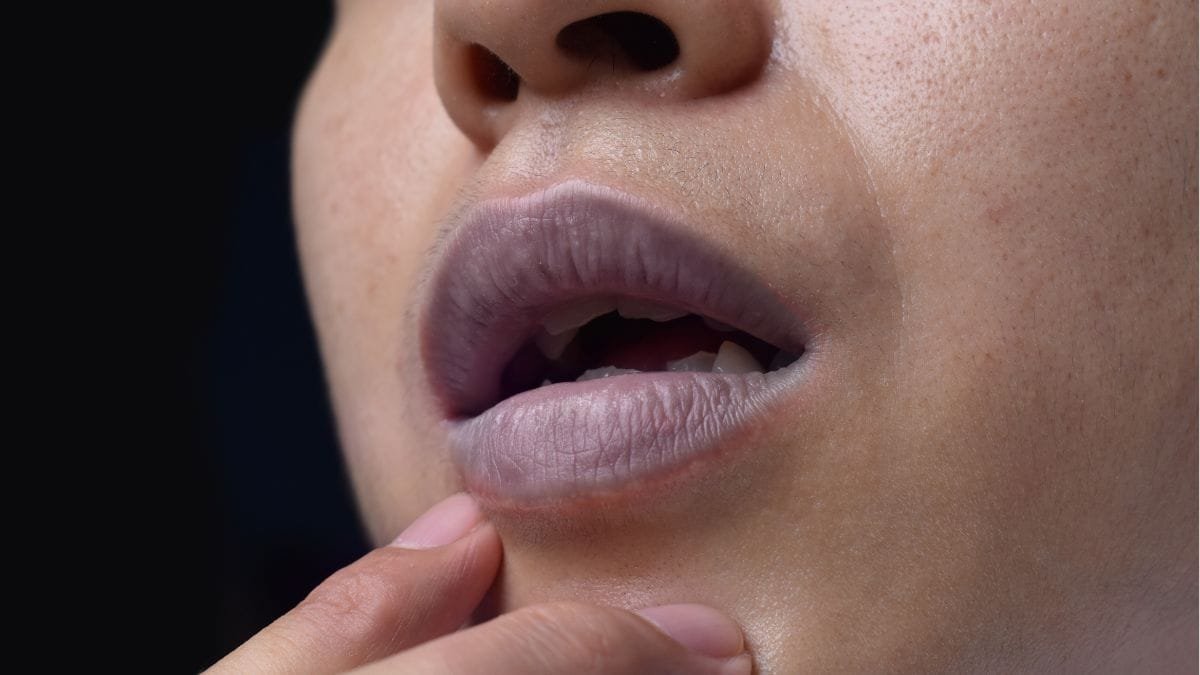 Are you worried about your lips being dark