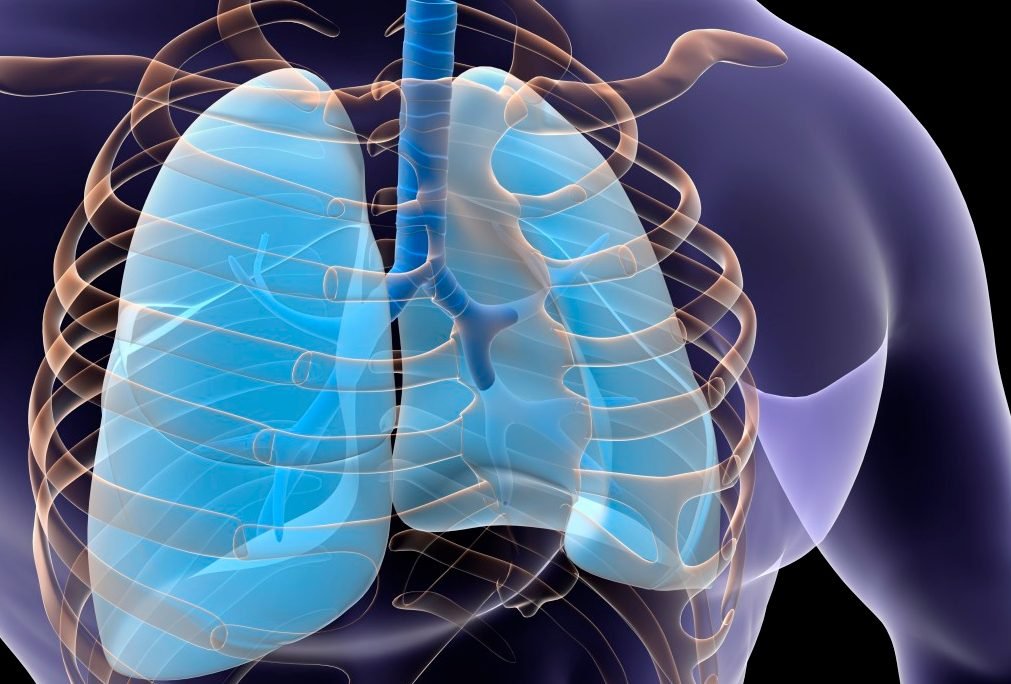 What to do if you have fluid in your lungs!! Here is the full description ??