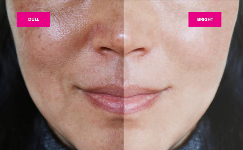 Is your skin getting dry Do this to make it glow