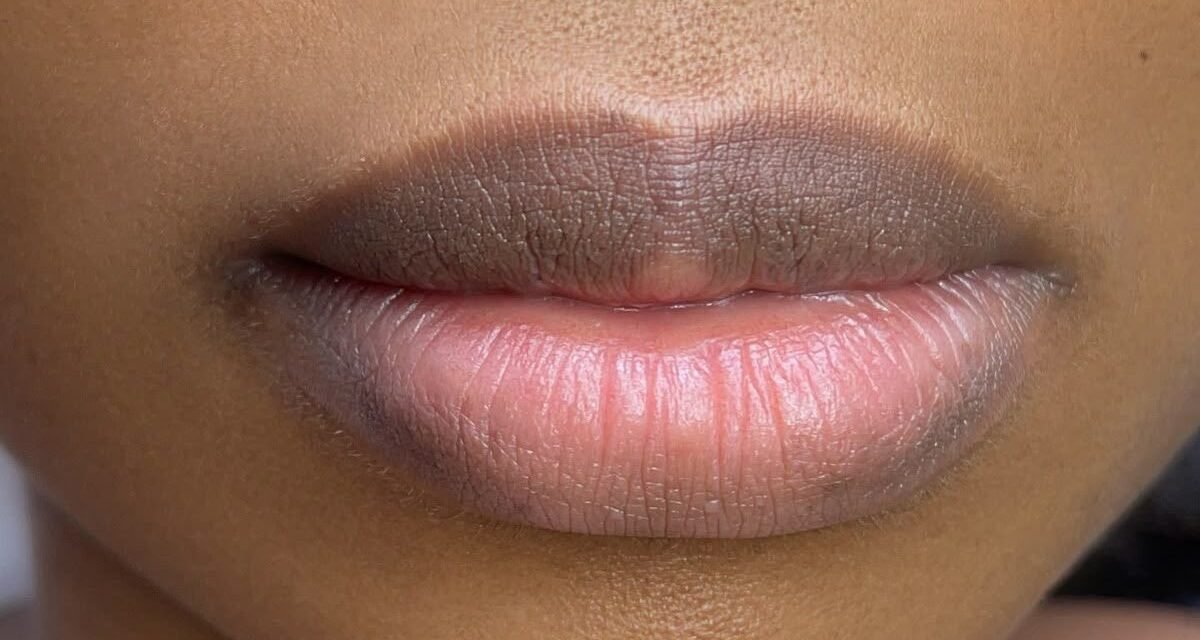 Why are your lips so black