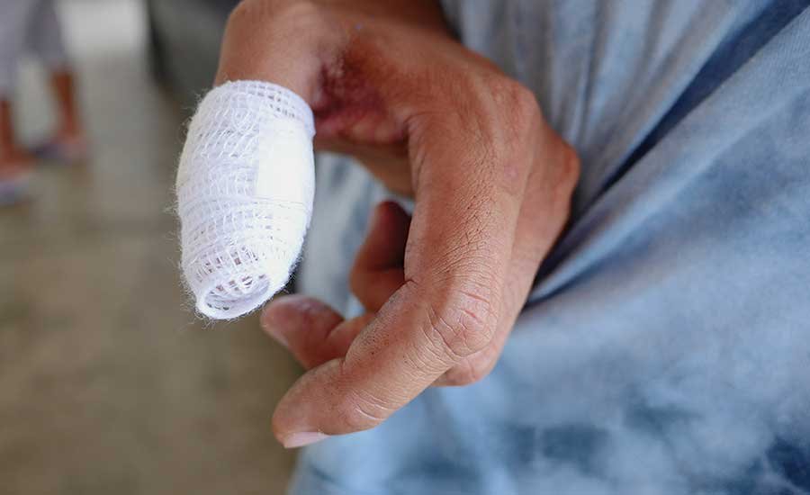A child's thumb was lost due to lack of attention.