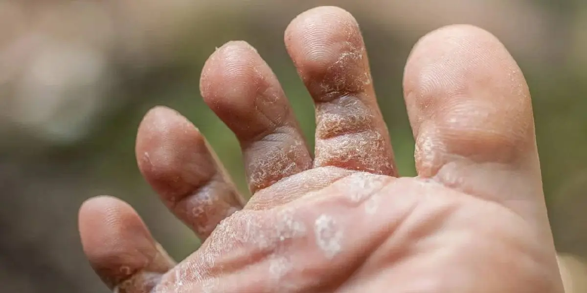 Is the mud a nuisance that never goes away